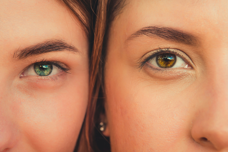 Woman comparing dull skin and glowing healthy skin